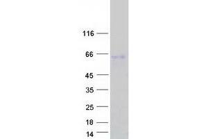 Validation with Western Blot