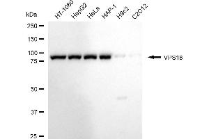 Western blotting analysis using VPS18 antibody (ABIN7800813).