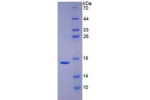 SDS-PAGE analysis of Human BMP6 Protein. (BMP6 Protein)