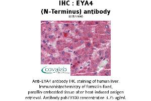 Image no. 1 for anti-Eyes Absent Homolog 4 (EYA4) (N-Term) antibody (ABIN1734196)