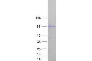 Sorbs2 Protein (Transcript Variant 1) (Myc-DYKDDDDK Tag)