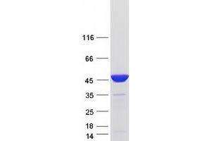 Western Blotting (WB) image for phosphoribosylaminoimidazole Carboxylase, phosphoribosylaminoimidazole Succinocarboxamide Synthetase (PAICS) (Transcript Variant 3) protein (Myc-DYKDDDDK Tag) (ABIN2712339)
