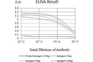 Black line: Control Antigen (100 ng),Purple line: Antigen (10 ng), Blue line: Antigen (50 ng), Red line:Antigen (100 ng) (CKM Antikörper  (AA 1-381))