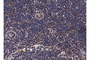 ABIN6266697 at 1/100 staining human lymph node tissue sections by IHC-P. (PDZD2 Antikörper  (N-Term))