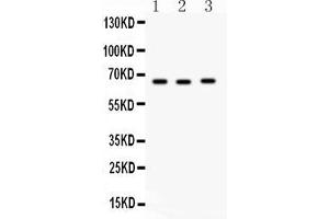 Anti-SLC19A1 Picoband antibody, Western blottingAll lanes: Anti SLC19A1  at 0. (SLC19A1 Antikörper  (Middle Region))