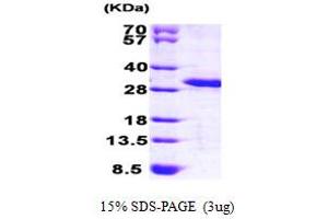 SDS-PAGE (SDS) image for MOB Family Member 4, Phocein (MOBKL3) (AA 1-225) protein (His tag) (ABIN667852) (MOBKL3 Protein (AA 1-225) (His tag))