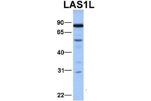 Western Blotting (WB) image for anti-LAS1-Like (LAS1L) (Middle Region) antibody (ABIN2775919)