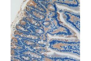 Used in DAB staining on fromalin fixed paraffin- embedded intestine tissue (PLAT Antikörper  (AA 311-487))