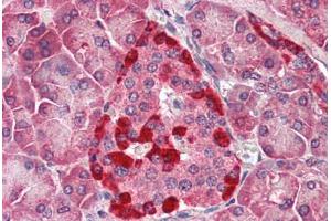Human Pancreas (formalin-fixed, paraffin-embedded) stained with CASP1 antibody ABIN461892 at 5 ug/ml followed by biotinylated goat anti-rabbit IgG secondary antibody ABIN481713, alkaline phosphatase-streptavidin and chromogen. (Caspase 1 Antikörper)