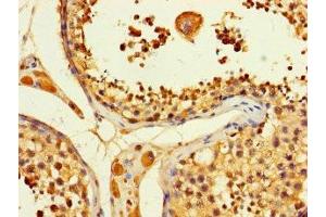 Immunohistochemistry of paraffin-embedded human testis tissue using ABIN7144946 at dilution of 1:100 (ACLY Antikörper  (AA 4-265))