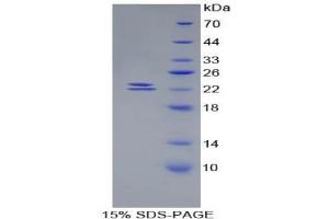 SDS-PAGE analysis of Mouse BMP1 Protein. (BMP1 Protein)