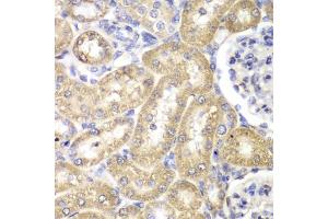 Immunohistochemistry of paraffin-embedded rat liver using HADH antibody (ABIN5970434) at dilution of 1/100 (40x lens). (HADH Antikörper)