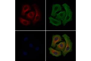 ABIN6265118 and ABIN6279217 staining Hela cells by IF/ICC.
