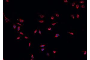 ABIN6266588 staining U-2 OS cells by IF/ICC. (MDM2 Antikörper)
