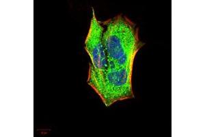 Immunofluorescence (IF) image for anti-Interleukin-1 Receptor-Associated Kinase 3 (IRAK3) (AA 454-596) antibody (ABIN5542522)