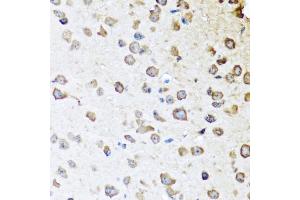 Immunohistochemistry of paraffin-embedded mouse brain using SERPINA10 antibody (ABIN5974273) at dilution of 1/100 (40x lens). (SERPINA10 Antikörper)