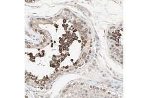 Immunohistochemical staining of human testis with JMJD2A polyclonal antibody  shows strong cytoplasmic positivity in cells in seminiferus ducts. (KDM4A Antikörper)