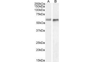 Western Blot using anti-BACE2 antibody 1/9 HeLa (A) and U251 (B) cell lysate samples (35 μg protein in RIPA buffer) were resolved on a 10 % SDS PAGE gel and blots probed with the chimeric mouse IgG1 version of 1/9 (ABIN7072331) at 1 μg/mL before detection using an anti-mouse secondary antibody. (Rekombinanter BACE2 Antikörper)