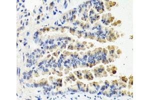 Immunohistochemistry of paraffin-embedded Mouse lung using NTF3 Polyclonal Antibody at dilution of 1:100 (40x lens). (Neurotrophin 3 Antikörper)