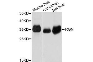 Western blot analysis of extracts of various cell lines, using RGN antibody. (Regucalcin Antikörper  (AA 1-299))