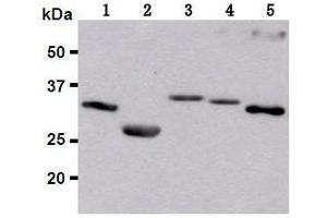 Western Blotting (WB) image for anti-Red Fluorescent Protein (RFP) antibody (ABIN1449291)
