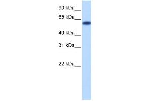 WB Suggested Anti-ZNF394 Antibody Titration: 0. (ZNF394 Antikörper  (N-Term))