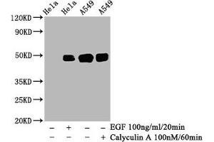 Western Blot  Positive WB detected in: Hela whole cell lysate, A549 whole cell lysate(treated with Calyculin A or EGF)  All lanes: Phospho-JUN antibody at 0. (Rekombinanter C-JUN Antikörper  (pSer63))