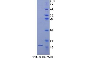 SDS-PAGE analysis of Rat CD3d Protein.