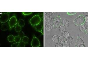 Immunocytochemistry (ICC) image for anti-ORAI Calcium Release-Activated Calcium Modulator 1 (ORAI1) (AA 200-212), (Extracellular) antibody (ABIN7043408)
