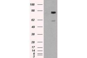 Western Blotting (WB) image for anti-Glucan (1,4-alpha-), Branching Enzyme 1 (GBE1) antibody (ABIN1498395) (GBE1 Antikörper)