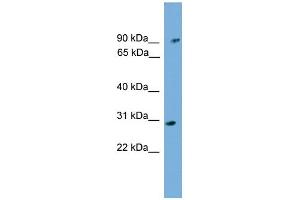 WB Suggested Anti-PHYH Antibody Titration: 0. (PHYH Antikörper  (N-Term))