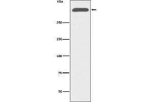 Western blot analysis of ApoB expression in human serum lysate.