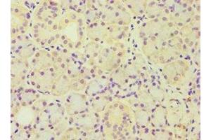 Immunohistochemistry of paraffin-embedded human pancreatic tissue using ABIN7143446 at dilution of 1:100 (ARF3 Antikörper  (AA 1-181))