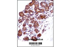 IMPDH1 Antibody immunohistochemistry analysis in formalin fixed and paraffin embedded human breast tissue followed by peroxidase conjugation of the secondary antibody and DAB staining. (IMPDH1 Antikörper  (N-Term))