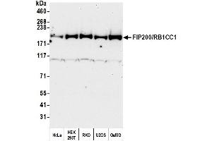 anti-RB1-Inducible Coiled-Coil 1 (RB1CC1) (AA 250-300) antibody