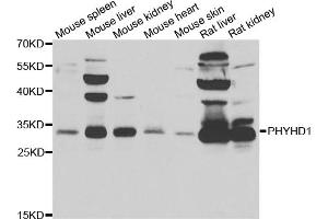 Western blot analysis of extracts of various cell lines, using PHYHD1 antibody. (PHYHD1 Antikörper)