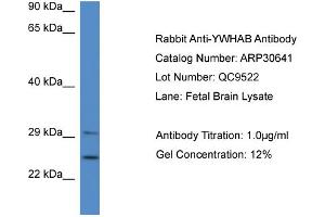 WB Suggested Anti-YWHAB Antibody   Titration: 1. (YWHAB Antikörper  (Middle Region))