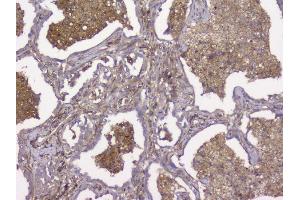 IHC analysis of Beta 2 Microglobulin using anti-Beta 2 Microglobulin antibody (ABIN6719452). (beta-2 Microglobulin Antikörper  (AA 22-119))