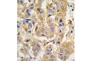 Image no. 1 for anti-Mitochondrial Intermediate Peptidase (MIPEP) (Center) antibody (ABIN356963) (MIPEP Antikörper  (Center))