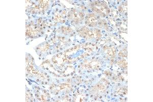 Immunohistochemistry (IHC) image for anti-Proteasome Subunit alpha 2 (PSMA2) antibody (ABIN7269597)