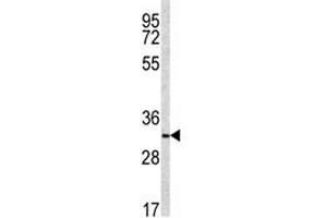 Western blot analysis of NQO1 antibody and NCI-H460 lysate (NQO1 Antikörper  (AA 118-144))