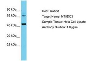 Image no. 1 for anti-5'-Nucleotidase Domain Containing 3 (NT5DC3) (AA 30-79) antibody (ABIN6750613) (NT5DC3 Antikörper  (AA 30-79))