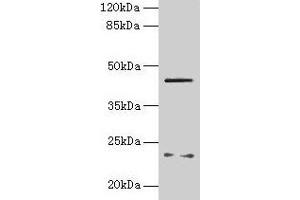 Western blot All lanes: FIBP antibody at 6 μg/mL + MCF-7 whole cell lysate Secondary Goat polyclonal to rabbit IgG at 1/10000 dilution Predicted band size: 42 kDa Observed band size: 42 kDa (FIBP Antikörper  (AA 2-357))