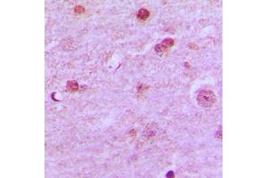 Immunohistochemical analysis of N4BP1 staining in human brain formalin fixed paraffin embedded tissue section. (N4BP1 Antikörper  (Center))