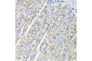 Immunohistochemistry of paraffin-embedded mouse stomach using OSGEPL1 antibody (ABIN5974954) at dilution of 1/100 (40x lens).