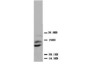 Western blot analysis of human placenta tissue lysis using PLGF antibody (PLGF Antikörper  (N-Term))