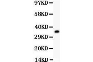 Western Blotting (WB) image for anti-Guanine Nucleotide Binding Protein (G Protein), beta Polypeptide 2-Like 1 (GNB2L1) (AA 2-317) antibody (ABIN3042427)
