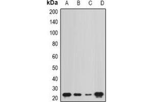 Western blot analysis of NCS1 expression in Hela (A), MCF7 (B), mouse bone marrow (C), rat kidney (D) whole cell lysates.