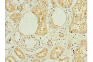 Immunohistochemistry of paraffin-embedded human kidney tissue using ABIN7172386 at dilution of 1:100 (L3HYPDH Antikörper  (AA 13-312))