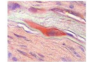 CSF1  CSF1 in human placenta was detected using HRP/AEC red color stain. (M-CSF/CSF1 Antikörper  (Middle Region))
